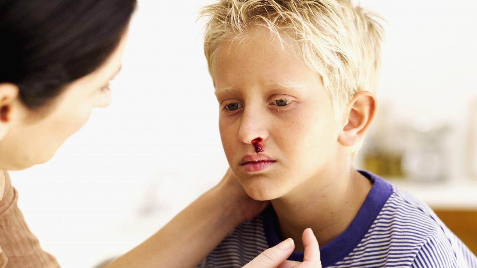 Boy With Golden Hair And Bleeding Nose
