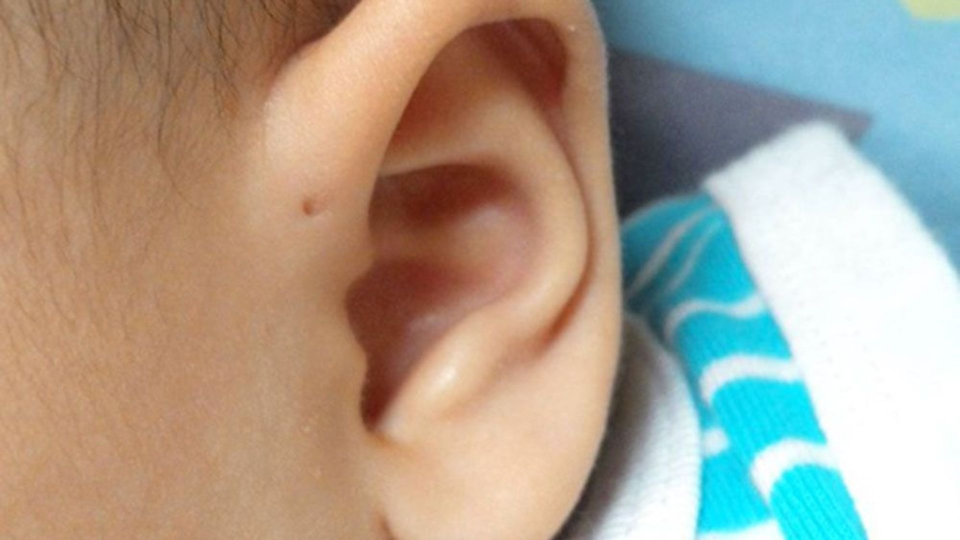 Hole In The Child's Ear