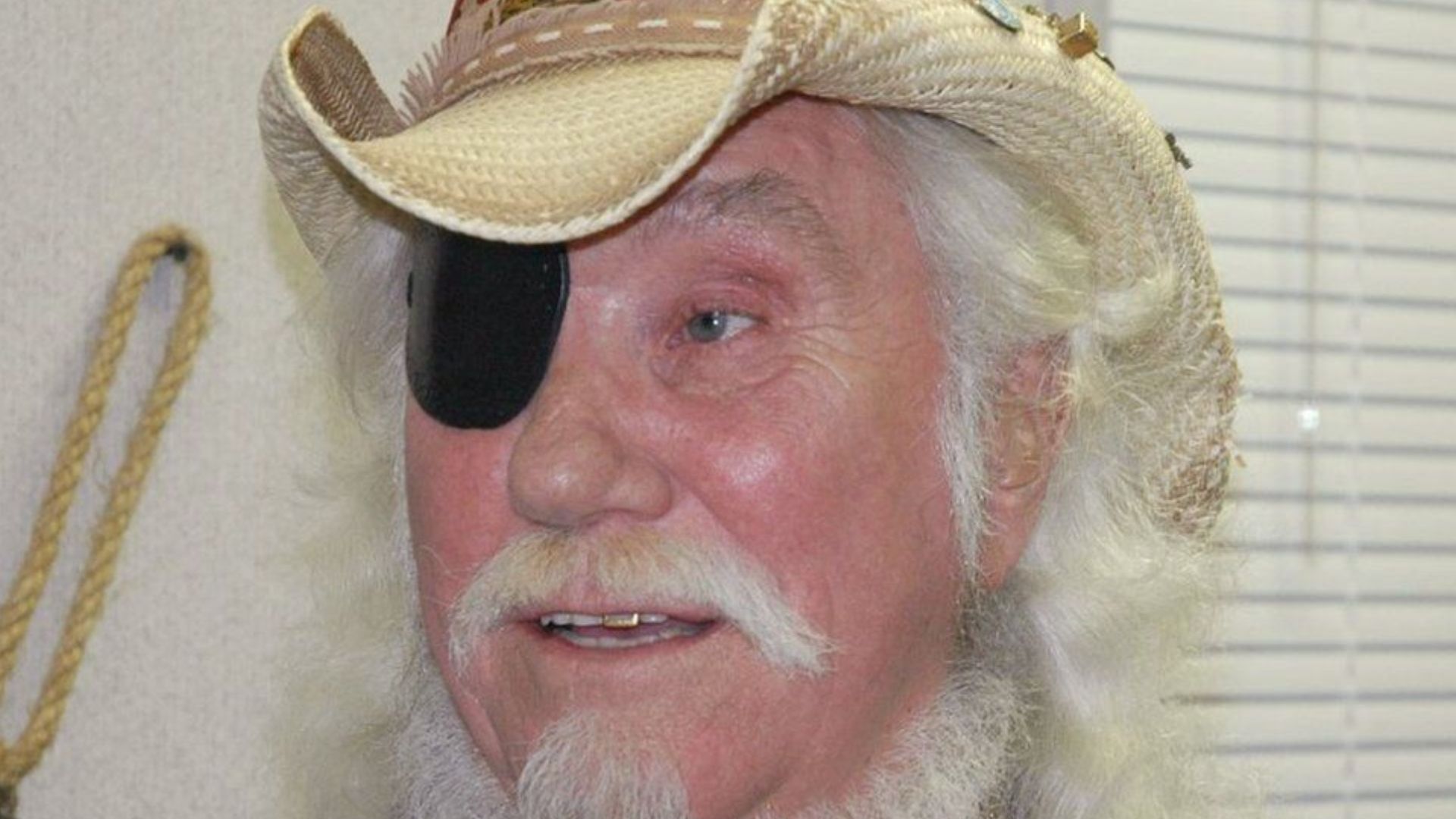 Ray Sawyer With An Eye Patch