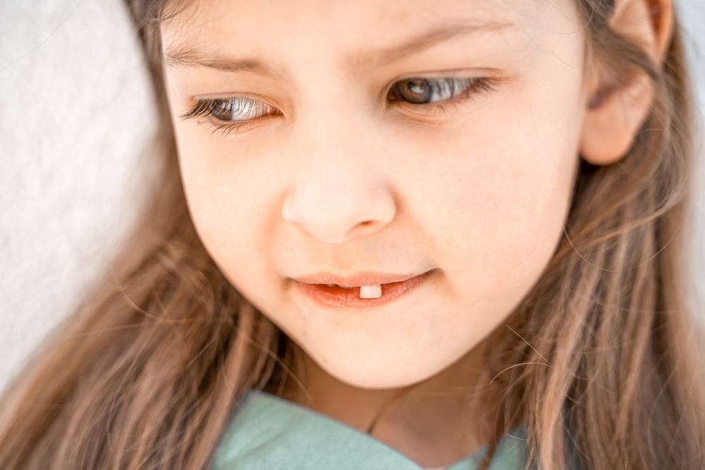 Charming little girl shows staggering loose front tooth.