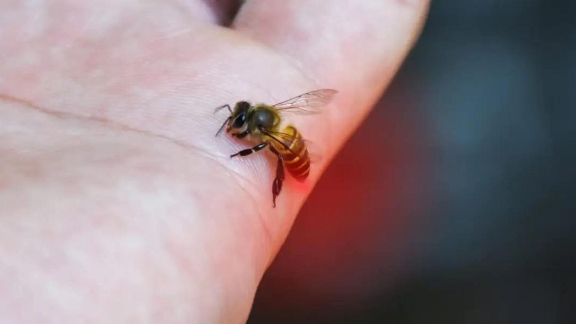Bee Sting Treatment - Remedies to Stop Pain Quickly